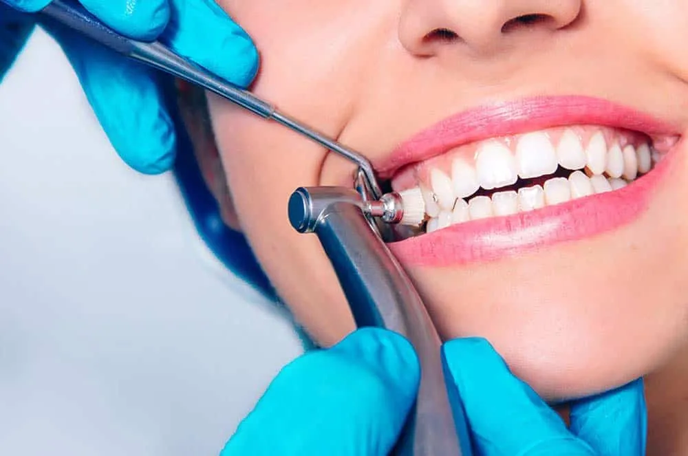 teeth cleaning