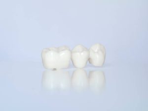 Getting Dental Crowns: Procedure, Care and Maintenance