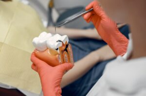 Root Canal vs. Tooth Extraction – Making the Right Choice