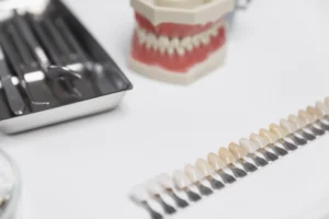 What is the Cost of Dental Implants in Scarborough