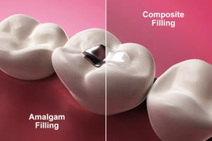 Seamless Dental Fillings in Scarborough: Natural-looking and Durable Restorations