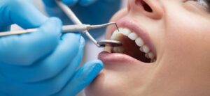 Your Trusted Markham Dentist: Transforming Smiles with Expert Care