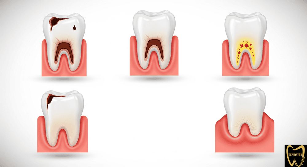 Common causes of tooth pain and toothache relief in Scarborough